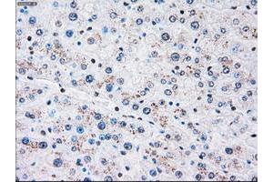 Image no. 9 for anti-Polo-Like Kinase 1 (PLK1) antibody (ABIN1500281)