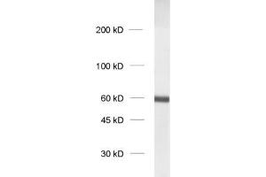dilution: 1 : 1000, sample: crude synaptosomal fraction of rat brain (P2) (SYT1 anticorps  (Lumenal Region))
