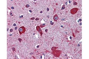 Anti-LRP8 antibody IHC of human brain, cortex.