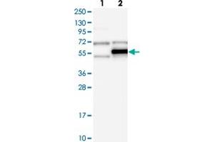 Western blot analysis of Lane 1: Negative control (vector only transfected HEK293T lysate), Lane 2: Over-expression Lysate (Co-expressed with a C-terminal myc-DDK tag (~3. (TRMT5 anticorps)