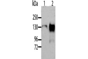 Western Blotting (WB) image for anti-Aldehyde Oxidase 1 (AOX1) antibody (ABIN2429101) (AOX1 anticorps)
