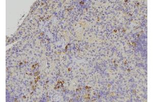 ABIN6278916 at 1/100 staining Human lymph node tissue by IHC-P. (Keratin 31 anticorps)