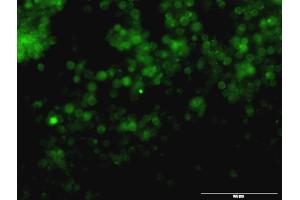 Immunofluorescence of monoclonal antibody to TYR on Jurkat cell.
