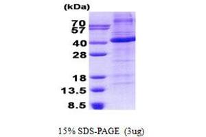 Image no. 1 for Follistatin (FST) (AA 30-344) protein (His tag) (ABIN6387152)