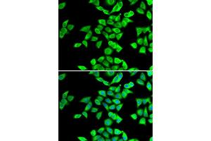 Immunofluorescence analysis of U20S cell using NMT2 antibody. (NMT2 anticorps)
