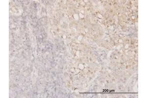 Image no. 3 for anti-Cofilin 1 (CFL1) (AA 1-167) antibody (ABIN598606) (Cofilin anticorps  (AA 1-167))
