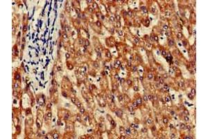 Immunohistochemistry of paraffin-embedded human liver tissue using ABIN7154260 at dilution of 1:100 (GRHPR anticorps  (AA 1-328))