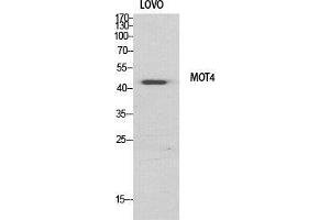 Western Blot (WB) analysis of specific cells using MCT4 Polyclonal Antibody. (SLC16A3 anticorps  (Internal Region))