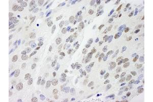 Immunohistochemistry (IHC) image for anti-Non-POU Domain Containing, Octamer-Binding (NONO) (AA 350-400) antibody (ABIN7448694) (NONO anticorps  (AA 350-400))