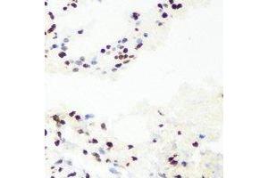 Immunohistochemical analysis of RNGTT staining in mouse lung formalin fixed paraffin embedded tissue section. (RNGTT anticorps)