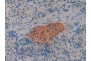 Detection of CBG in Rat Spleen Tissue using Polyclonal Antibody to Corticosteroid Binding Globulin (CBG)