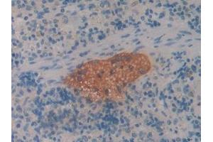 Detection of CBG in Rat Spleen Tissue using Polyclonal Antibody to Corticosteroid Binding Globulin (CBG) (SERPINA6 anticorps  (AA 267-390))
