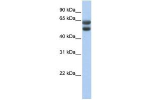 WB Suggested Anti-ZNF331 Antibody Titration:  0. (ZNF331 anticorps  (N-Term))