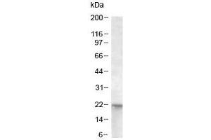 Western blot of A431 lysate with NRAS antibody at 0.