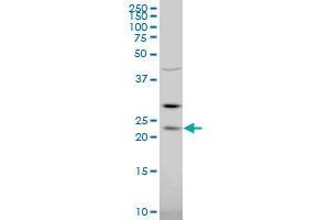 RGS5 polyclonal antibody (A01), Lot # 060608JCS1 Western Blot analysis of RGS5 expression in K-562 . (RGS5 anticorps  (AA 94-181))