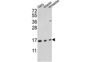 Western blot analysis of PPIA Antibody (PPIA anticorps  (N-Term))