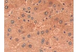 Detection of PKLR in Human Liver Tissue using Polyclonal Antibody to Pyruvate kinase isozymes R/L (PKLR)