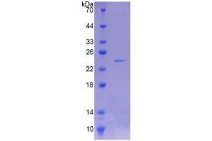 SDS-PAGE analysis of Rat NTE Protein. (PNPLA6 Protéine)