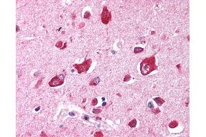 Anti-TRIM35 antibody IHC of human brain, cortex.