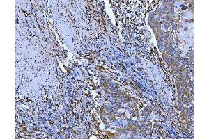 IHC analysis of Hsp47/SERPINH1 using anti-Hsp47/SERPINH1 antibody (ABIN3043331). (SERPINH1 anticorps  (AA 247-418))