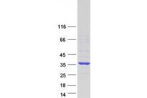 Validation with Western Blot