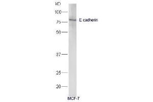 Western Blotting (WB) image for anti-Cadherin 1, Type 1, E-Cadherin (Epithelial) (CDH1) (AA 401-500) antibody (ABIN1387847)