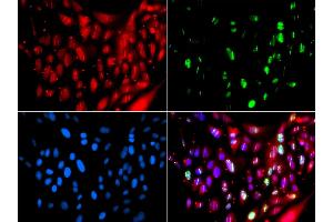 Immunofluorescence analysis of GFP-RNF168 trangenic U2OS cell using UIMC1 antibody.