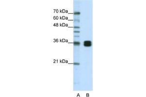 Western Blotting (WB) image for anti-Heterogeneous Nuclear Ribonucleoprotein A0 (HNRNPA0) antibody (ABIN2462229) (HNRNPA0 anticorps)