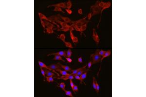 Immunofluorescence analysis of PC-12 cells using SEC61 Rabbit pAb (1614) at dilution of 1:350 (40x lens).