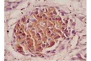 anti-Preptin antibody