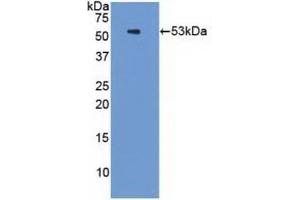 Detection of Recombinant PSMC3, Human using Polyclonal Antibody to Proteasome 26S Subunit, ATPase 3 (PSMC3)