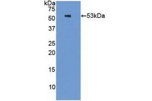 Detection of Recombinant PSMC3, Human using Polyclonal Antibody to Proteasome 26S Subunit, ATPase 3 (PSMC3) (PSMC3 anticorps  (AA 2-439))