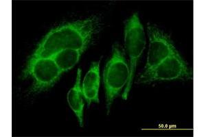 Immunofluorescence of purified MaxPab antibody to HK1 on HeLa cell.