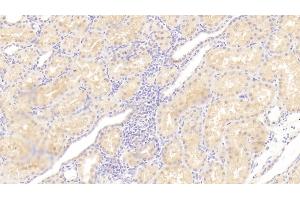 Detection of IL23a in Human Kidney Tissue using Polyclonal Antibody to Interleukin 23 Subunit Alpha (IL23a)