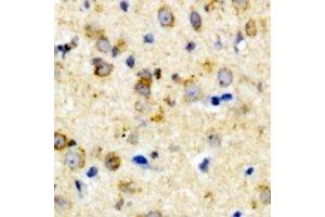 Immunohistochemical analysis of CALHM1 staining in rat brain formalin fixed paraffin embedded tissue section. (CALHM1 anticorps)