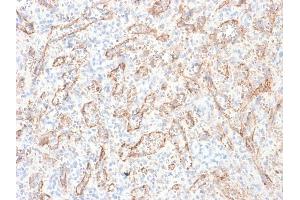 Formalin-fixed, paraffin-embedded human Spleen stained with VEGI Mouse Recombinant Monoclonal Antibody (rVEGI /1283).