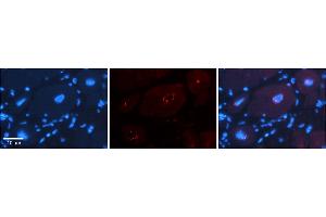 Rabbit Anti-DPF3 Antibody    Formalin Fixed Paraffin Embedded Tissue: Human Adult heart  Observed Staining: Nuclear Primary Antibody Concentration: 1:600 Secondary Antibody: Donkey anti-Rabbit-Cy2/3 Secondary Antibody Concentration: 1:200 Magnification: 20X Exposure Time: 0.