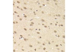 Immunohistochemistry of paraffin-embedded mouse brain using JMJD6 Antibody (ABIN5973452) at dilution of 1/200 (40x lens). (JMJD6 anticorps)