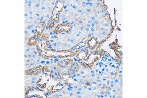 Immunohistochemistry of paraffin-embedded Mouse kidney using C Rabbit pAb (ABIN3022800, ABIN3022801, ABIN3022802 and ABIN6219234) at dilution of 1:50 (40x lens). (CAPZA2 anticorps  (AA 1-286))