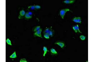 Immunofluorescent analysis of MCF-7 cells using ABIN7154186 at dilution of 1:100 and Alexa Fluor 488-congugated AffiniPure Goat Anti-Rabbit IgG(H+L)