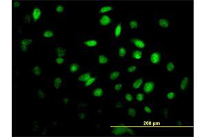 Immunofluorescence of monoclonal antibody to FOXF2 on HeLa cell. (FOXF2 anticorps  (AA 346-443))