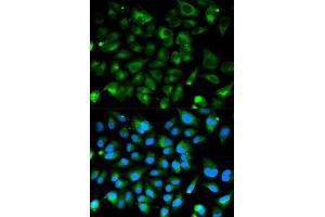 Immunofluorescence analysis of HeLa cell using PRKAR1A antibody. (PRKAR1A anticorps  (AA 1-250))