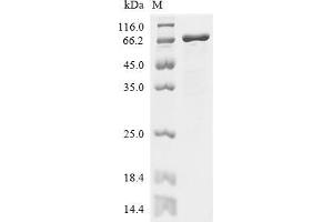 (Tris-Glycine gel) Discontinuous SDS-PAGE (reduced) with 5 % enrichment gel and 15 % separation gel.