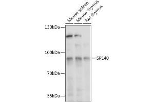 Western blot analysis of extracts of various cell lines, using SP140 antibody (ABIN7270507) at 1:1000 dilution. (SP140 anticorps  (AA 1-180))