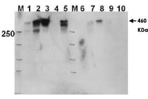 Western blot using PRKDC (phospho T2609) polyclonal antibody  shows detection of a 460 KDa band corresponding to human PRKDC in various preparations. (PRKDC anticorps  (pThr2609))