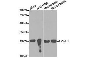 Western Blotting (WB) image for anti-Ubiquitin Carboxyl-terminal Esterase L1 (Ubiquitin Thiolesterase) (UCHL1) antibody (ABIN1875266) (UCHL1 anticorps)
