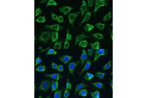 Immunofluorescence analysis of L-929 cells using PTPN22 antibody (ABIN3021952, ABIN3021953, ABIN1513449 and ABIN6218285) at dilution of 1:100.
