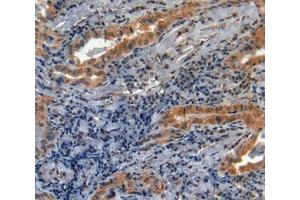 Used in DAB staining on fromalin fixed paraffin- embedded thyroid cancer tissue (MMP11 anticorps  (AA 277-488))