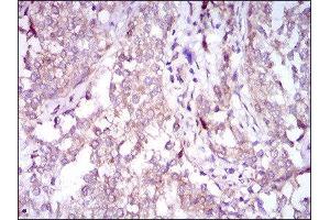 Immunohistochemistry (IHC) image for anti-Sequestosome 1 (SQSTM1) (AA 232-356) antibody (ABIN1846090) (SQSTM1 anticorps  (AA 232-356))