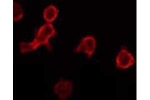 ABIN6275015 staining RAW264. (CKLF anticorps)